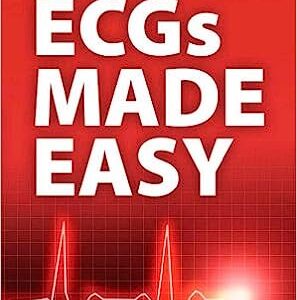Test Bank For ECGs Made Easy 5th Edition By Aehlert